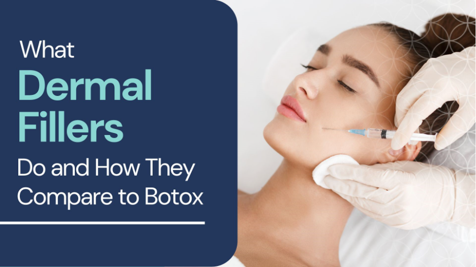 Woman receiving a dermal filler injection in her cheek, with text explaining what dermal fillers do and how they compare to Botox.